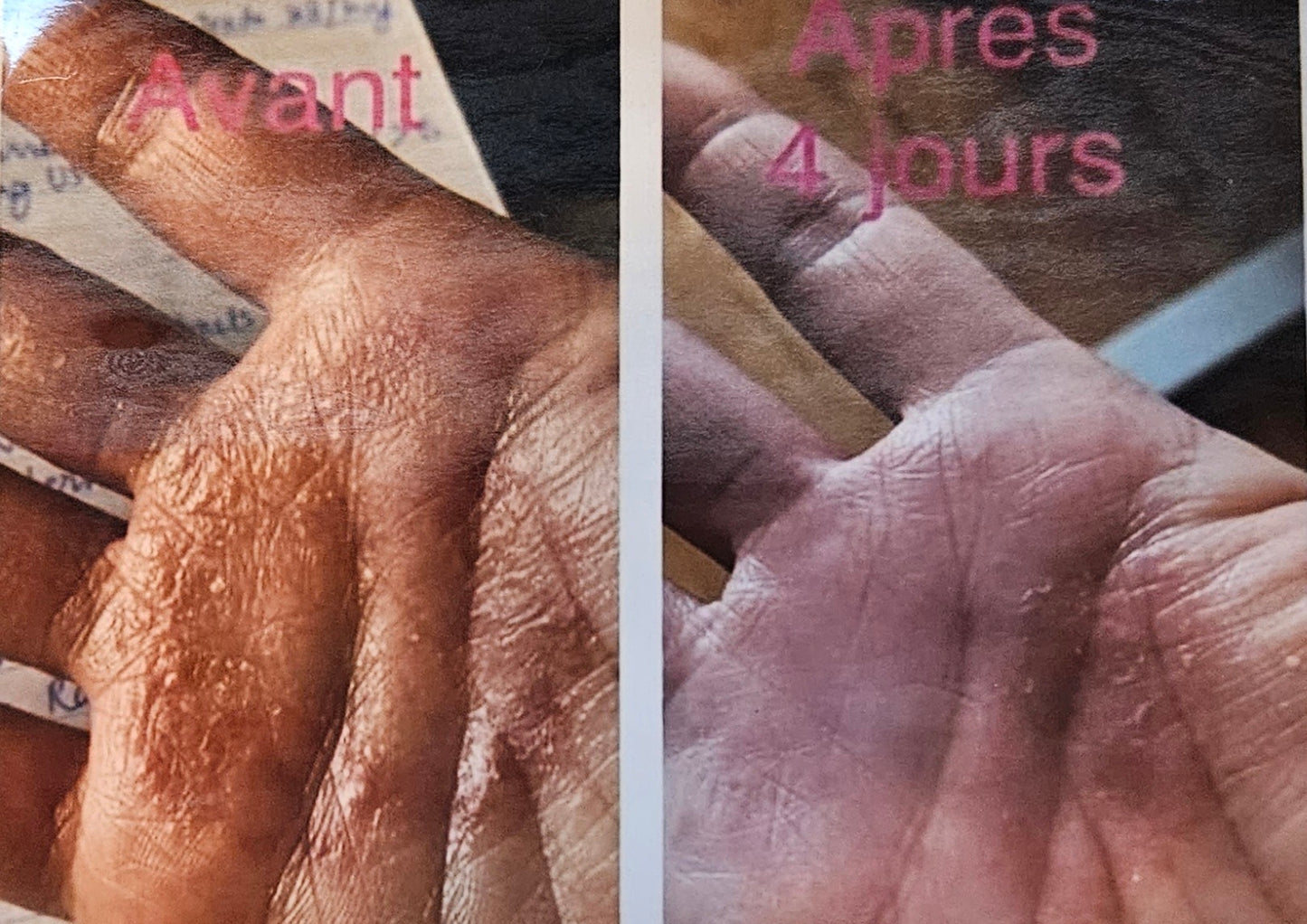 Baume Adieu eczéma